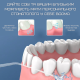Беспроводной Ирригатор Для Полости Рта Дорожный Портативный Уход за Зубами Professional 3 Режима Мощности + 2 Насадки NiceFeel FC3980